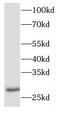 DnaJ Heat Shock Protein Family (Hsp40) Member B9 antibody, FNab02455, FineTest, Western Blot image 