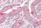 Vesicle-associated membrane protein 7 antibody, MBS248631, MyBioSource, Immunohistochemistry paraffin image 