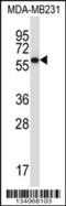 Protein Phosphatase 2 Regulatory Subunit B'Gamma antibody, 57-430, ProSci, Western Blot image 