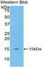 Thymic Stromal Lymphopoietin antibody, LS-C296624, Lifespan Biosciences, Western Blot image 