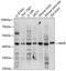 Gastrin Releasing Peptide Receptor antibody, GTX66421, GeneTex, Western Blot image 