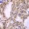 DNA Polymerase Delta 3, Accessory Subunit antibody, GTX32795, GeneTex, Immunohistochemistry paraffin image 