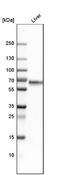 Kininogen 1 antibody, NBP1-89994, Novus Biologicals, Western Blot image 