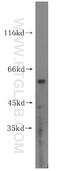 Mitogen-Activated Protein Kinase Kinase 5 antibody, 15758-1-AP, Proteintech Group, Western Blot image 