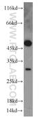 Tetraspanin-1 antibody, 16058-1-AP, Proteintech Group, Western Blot image 