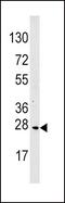 MOB Kinase Activator 1B antibody, PA5-13769, Invitrogen Antibodies, Western Blot image 