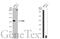 Ribonucleotide Reductase Regulatory Subunit M2 antibody, GTX103193, GeneTex, Western Blot image 