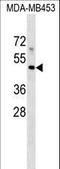 Major Histocompatibility Complex, Class I-Related antibody, LS-C158294, Lifespan Biosciences, Western Blot image 