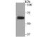 Potassium Voltage-Gated Channel Subfamily A Member 5 antibody, NBP2-76939, Novus Biologicals, Western Blot image 