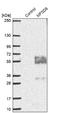 Major Facilitator Superfamily Domain Containing 8 antibody, NBP1-92114, Novus Biologicals, Western Blot image 