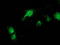 Catalase antibody, LS-C172722, Lifespan Biosciences, Immunofluorescence image 