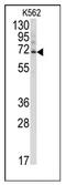 Ubiquilin 3 antibody, AP12096PU-N, Origene, Western Blot image 