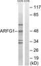 ADP Ribosylation Factor GTPase Activating Protein 1 antibody, GTX87479, GeneTex, Western Blot image 