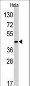 RAD9 Checkpoint Clamp Component A antibody, LS-C100164, Lifespan Biosciences, Western Blot image 