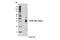 Triggering Receptor Expressed On Myeloid Cells 2 antibody, 91068S, Cell Signaling Technology, Western Blot image 