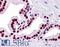 SMAD Family Member 6 antibody, LS-B4367, Lifespan Biosciences, Immunohistochemistry paraffin image 