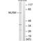 Mitochondrially Encoded NADH:Ubiquinone Oxidoreductase Core Subunit 5 antibody, A03488, Boster Biological Technology, Western Blot image 