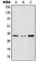 NFKB Inhibitor Alpha antibody, orb214312, Biorbyt, Western Blot image 