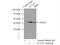 Actin Alpha 2, Smooth Muscle antibody, 23081-1-AP, Proteintech Group, Immunoprecipitation image 