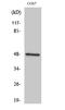 Inhibitor Of Nuclear Factor Kappa B Kinase Regulatory Subunit Gamma antibody, STJ93670, St John