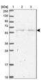 Solute Carrier Family 25 Member 23 antibody, NBP2-13321, Novus Biologicals, Western Blot image 