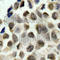 Histone Deacetylase 8 antibody, AP0360, ABclonal Technology, Immunohistochemistry paraffin image 
