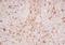 Interleukin 12B antibody, orb184406, Biorbyt, Immunohistochemistry paraffin image 