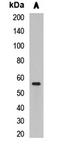 Chromobox 4 antibody, LS-C668133, Lifespan Biosciences, Western Blot image 