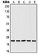 RAS Like Proto-Oncogene B antibody, LS-C352753, Lifespan Biosciences, Western Blot image 