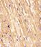 SMAD Family Member 1 antibody, M00728-2, Boster Biological Technology, Immunohistochemistry paraffin image 