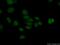 Histone Deacetylase 8 antibody, 17548-1-AP, Proteintech Group, Immunofluorescence image 
