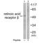 Retinoic Acid Receptor Beta antibody, GTX17593, GeneTex, Western Blot image 