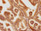 Proteasome 26S Subunit, Non-ATPase 6 antibody, CSB-PA614875PA01HU, Cusabio, Immunohistochemistry paraffin image 