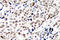 Checkpoint Kinase 1 antibody, LS-C177888, Lifespan Biosciences, Immunohistochemistry frozen image 