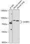 SH3 Domain Binding Protein 2 antibody, 13-525, ProSci, Western Blot image 