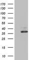 Ornithine Carbamoyltransferase antibody, M00721, Boster Biological Technology, Western Blot image 