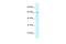 Zinc Finger Protein 212 antibody, A13693, Boster Biological Technology, Western Blot image 