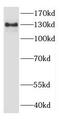 Cytoplasmic FMR1 Interacting Protein 2 antibody, FNab02140, FineTest, Western Blot image 