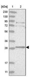 Thioredoxin Domain Containing 9 antibody, PA5-56876, Invitrogen Antibodies, Western Blot image 