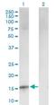 Cyclin Dependent Kinase Inhibitor 2B antibody, H00001030-B02P, Novus Biologicals, Western Blot image 