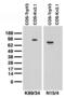 Transient Receptor Potential Cation Channel Subfamily V Member 3 antibody, 73-043, Antibodies Incorporated, Western Blot image 