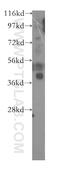 Ankyrin Repeat And BTB Domain Containing 1 antibody, 11095-1-AP, Proteintech Group, Western Blot image 