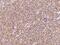 Inhibitor Of Nuclear Factor Kappa B Kinase Subunit Epsilon antibody, 203067-T08, Sino Biological, Immunohistochemistry frozen image 