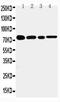 TNF Receptor Superfamily Member 1B antibody, LS-C313108, Lifespan Biosciences, Western Blot image 