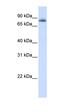 Signal Transducer And Activator Of Transcription 5A antibody, orb329976, Biorbyt, Western Blot image 