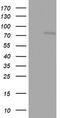 2'-5'-Oligoadenylate Synthetase 2 antibody, M01878, Boster Biological Technology, Western Blot image 