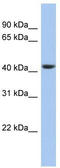 Stomatin-like protein 3 antibody, TA340409, Origene, Western Blot image 
