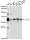 Cyclin D2 antibody, A1773, ABclonal Technology, Western Blot image 