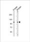 Glucosylceramidase Beta 2 antibody, PA5-72342, Invitrogen Antibodies, Western Blot image 