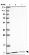 Pterin-4 Alpha-Carbinolamine Dehydratase 1 antibody, PA5-58017, Invitrogen Antibodies, Western Blot image 